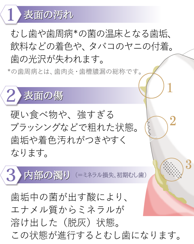 エナメル質の健康を損なう原因　1.表面の汚れ　2.表面の傷（目に見えないミクロの傷）　3.内部の濁り（ミネラル損失、初期むし歯）